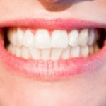 Aktualna technika wykorzystywana w salonach stomatologii estetycznej może spowodować, że odzyskamy prześliczny uśmiech.
